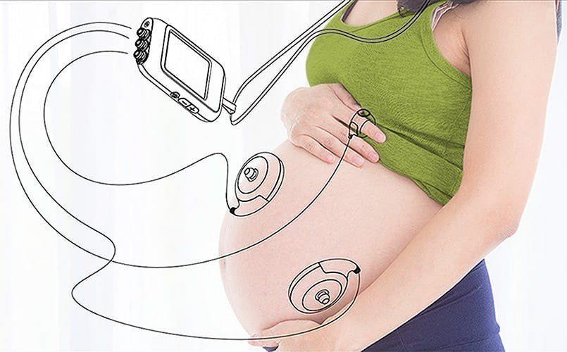 Резидент ОЭЗ «Технополис Москва» запустит производство устройств для удаленного ведения беременности